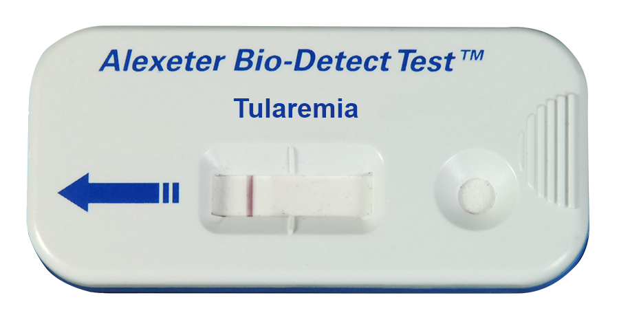 Tularemia Toxin Kit (25/box) — P/N 1670-0007
